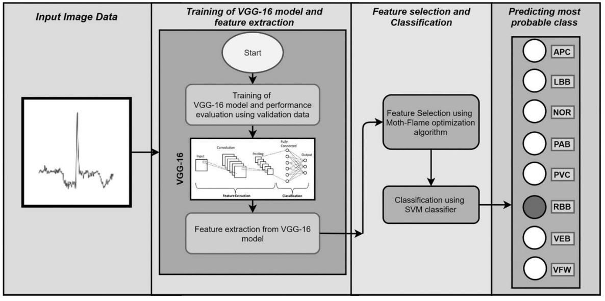 Parkinson's Disease Detection Diagram